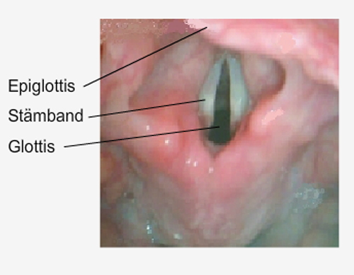intubation 4 2