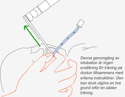 intubation 6