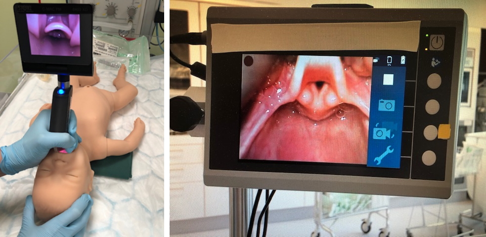 Videolaryngoskop